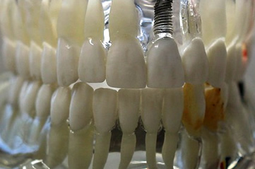 dentures - Set your teeth on edge at the Victoria Gallery. [ATTDT]